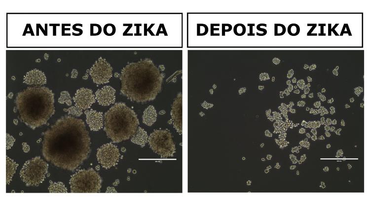 Pesquisa da USP sobre zika e tumores - Divulgação/USP - Divulgação/USP