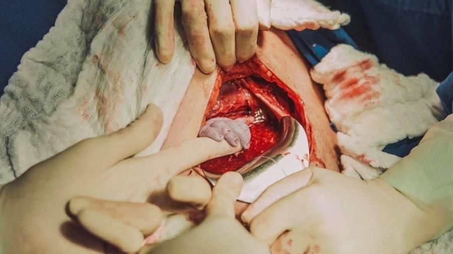 A filha da catarinense Mariana Floriano de Senna agarrou o dedinho da obstetra ao nascer - Reprodução/Facebook