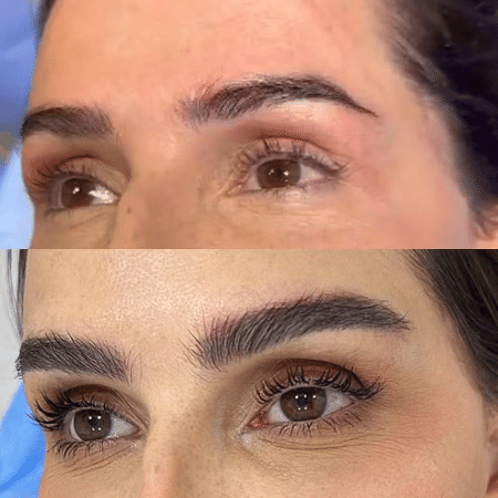 Deborah Secco realiza transplante de sobrancelha; veja antes e depois Deborah Secco realiza transplante de sobrancelha; veja antes e depois