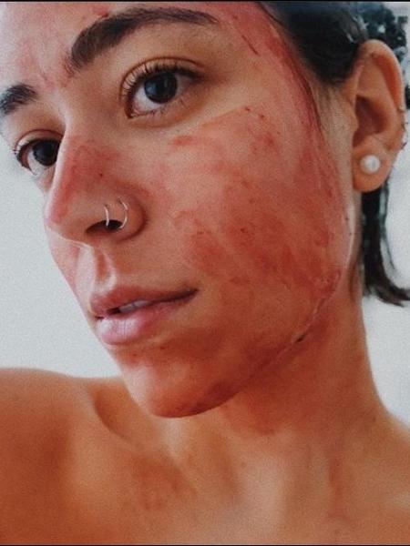 Influencer Luisa Moraleida fez um post em seu perfil no Instagram contando que passa sangue de menstruação no rosto - Reprodução Instagram @luisamoraleida