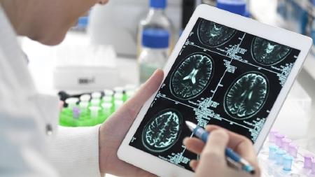 Estudos científicos mostraram alterações no cérebro em exames de imagem de pacientes que tiveram covid - Getty Images - Getty Images