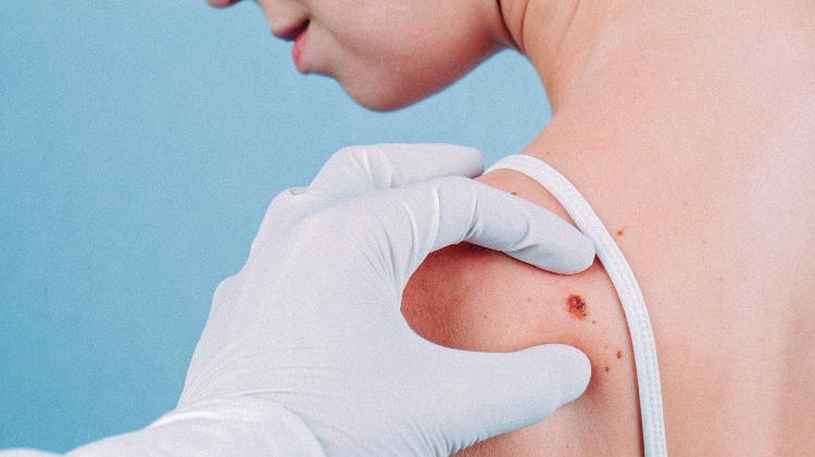 Pintas - iStock - iStock