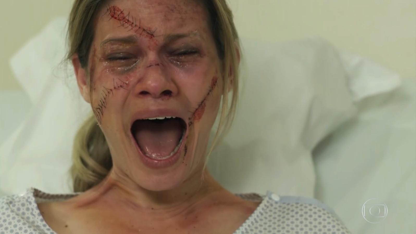 Vilã de "Haja Coração", Karen terminou a novela com a aparência transformada após se ferir gravemente em um acidente de carro. Ela interpretada por Karen Junqueira sobreviveu, mas apareceu com vários hematomas e pontos pelo rosto, para desespero da megera - Reprodução/TV Globo
