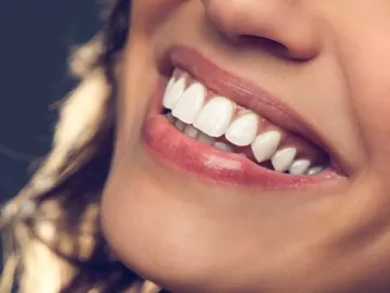 5 truques para ter dentes mais brancos de forma natural