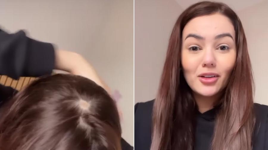 Eslovênia descobre alopecia - Reprodução/Instagram