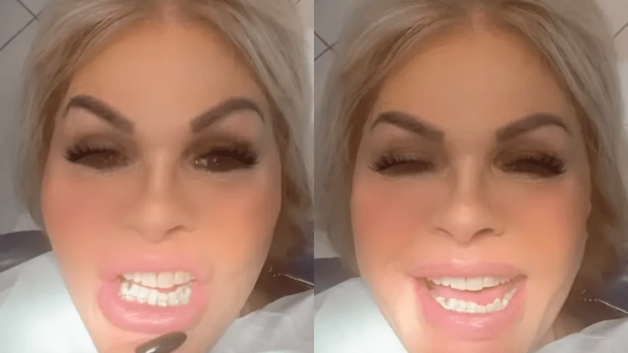 Monique Evans coloca aparelho nos dentes após receber críticas nas redes - Instagram