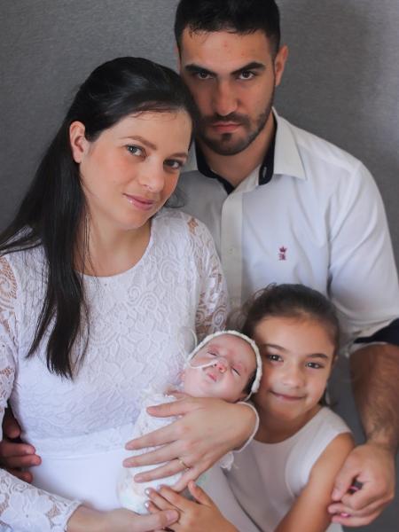 Emanoela Pereira da Rosa descobriu com 13 semanas de gestação que sua filha Ayla tinha a sindrome de Tetra-amelia