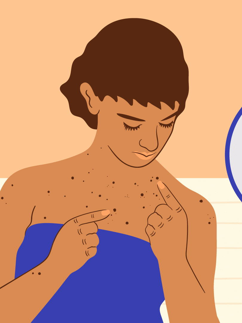 Câncer de mama em homens: 5 sinais para ficar de olho