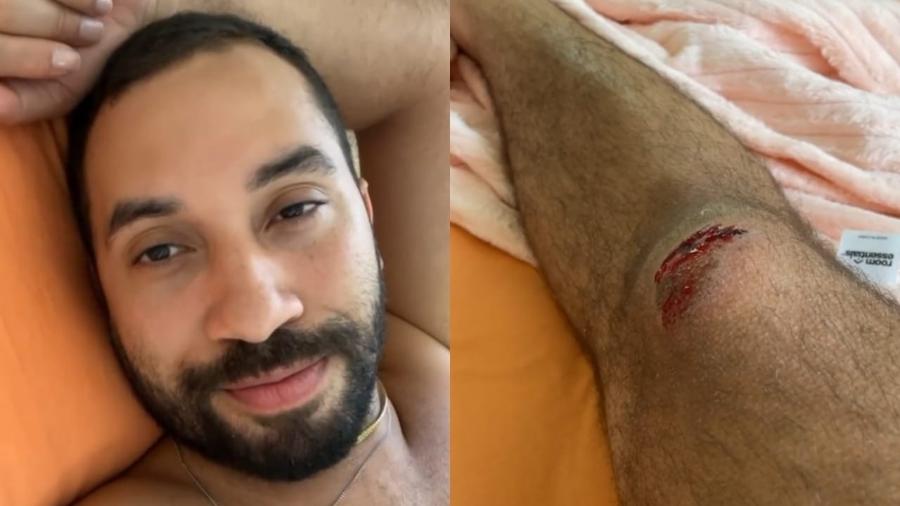 Gil do Vigor cai de bicicleta e desabafa com seus seguidores - Reprodução/Instagram