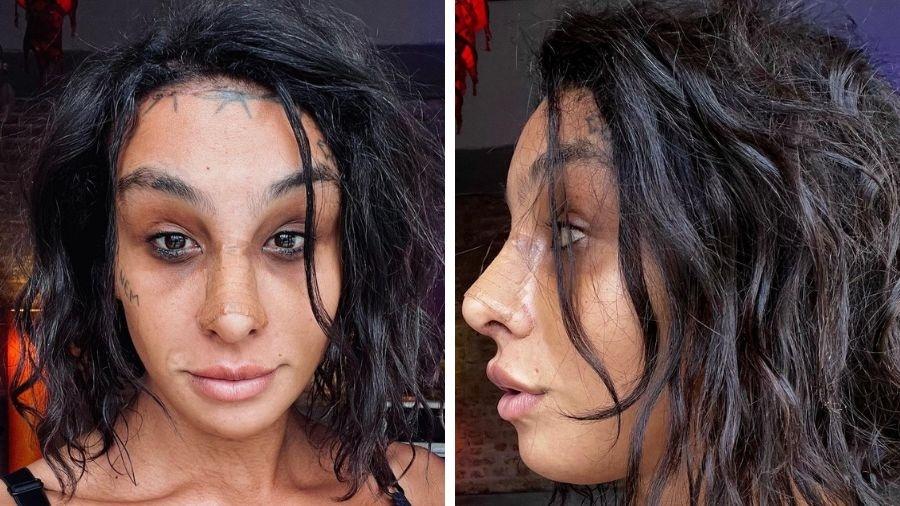 Linn da Quebrada aparece com faixa no nariz e rosto desinchado 18 dias após feminização facial - Reprodução/Instagram