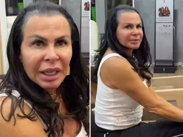 Gretchen surge sem prótese capilar: 'Perdi todo o cabelo'