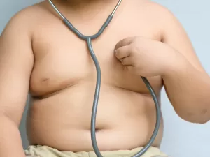 Brasil tem mais crianças com obesidade do que a média global
