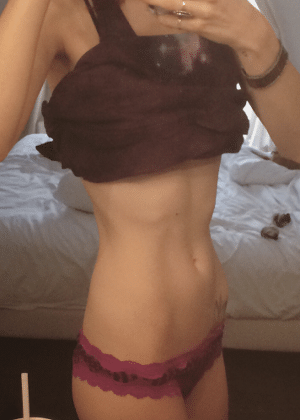 A atriz Chloe Dykstra postou imagem para mostrar a fase onde enfrentou anorexia - Reprodução - Reprodução