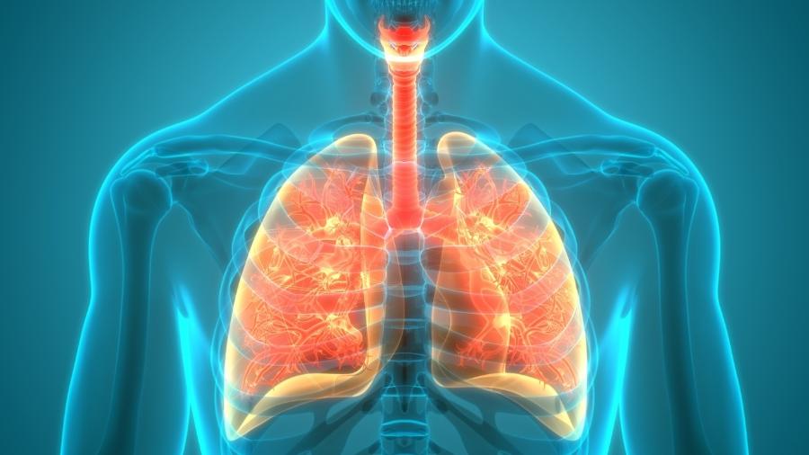 Os pesquisadores encontraram uma quantidade muito maior das enzimas metaloproteinases MMP-2 e MMP-3 nos pulmões de pacientes com covid-19 grave ou que foram a óbito pela doença - iStock