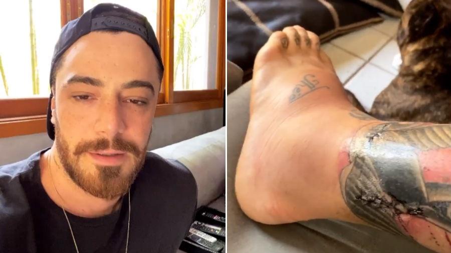 Felipe Titto mostra a perna mordida por cachorro inchada - Reprodução/Instagram