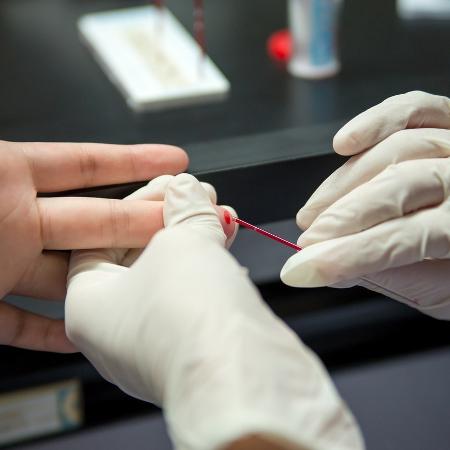Teste de HIV será por punção digital - SubstanceP/iStock