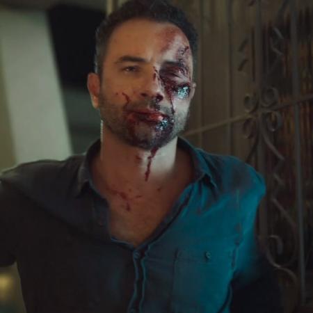 Montgomery (Marco Luque) aparece com o rosto desfigurado após apanhar na série Eu, a Vó e a Boi - Reprodução/TV Globo - Reprodução/TV Globo