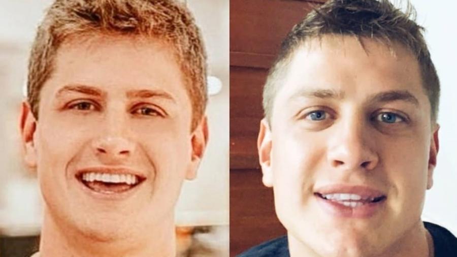 O ex-BBB Lucas Gallina, antes e depois de harmonização facial - Reprodução/Instagram