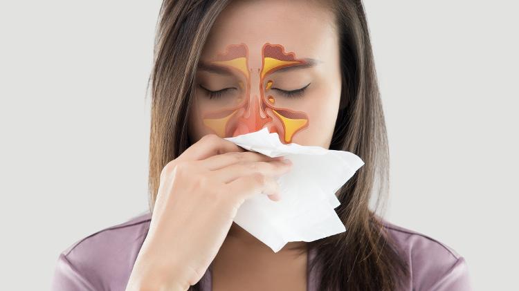 O que é sinusite? É uma inflamação seios da face
