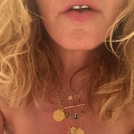 Madonna publica imagem de seu "grillz" - Reprodução/Instagram