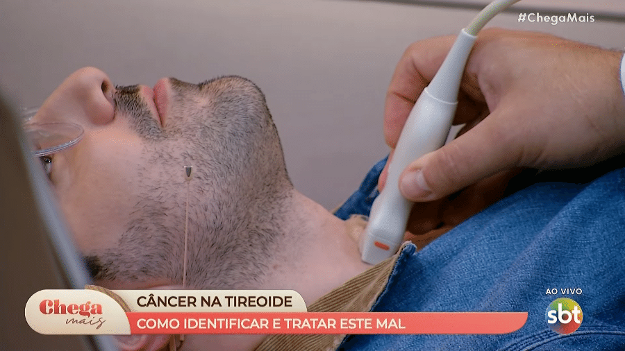 Paulo Mathias fez o ultrassom de tireoide ao vivo no 'Chega Mais'