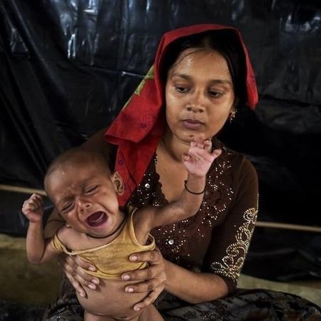 criança, fome - A desnutrição é um problema que afeta mais de 150 milhões de crianças em todo o mundo, diz OMS