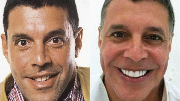 Alexandre Frota - Montagem - Montagem