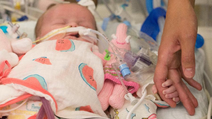 Georgia Bowen na unidade de terapia intensiva do Hospital Infantil de Boston no dia 16 de junho de 2018. Médicos tentaram reviver o coração do bebê com uma infusão de um bilhão de mitocôndrias - Katherine Taylor/The New York Times