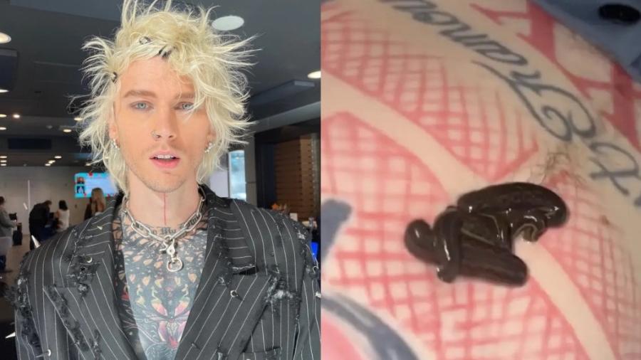 Machine Gun Kelly mostra sanguessugas na barriga - Reprodução/Instagram