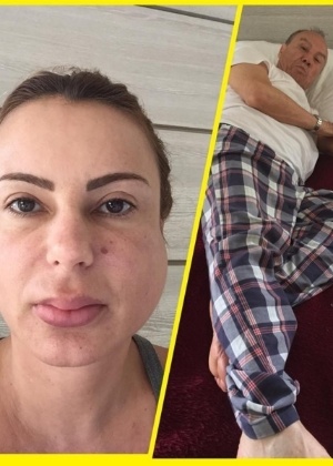 Marilene Saade posta foto no Instagram do seu rosto inchado e reclama de dor - Reprodução/Instagram/mari_saade