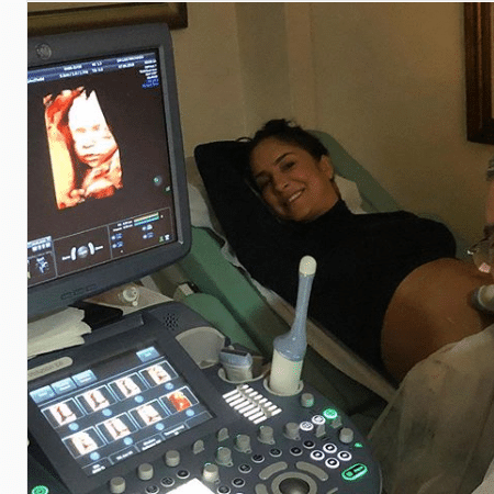 Claudia Leitte vê rostinho da filha durante ultrassom - Reprodução/Instagram