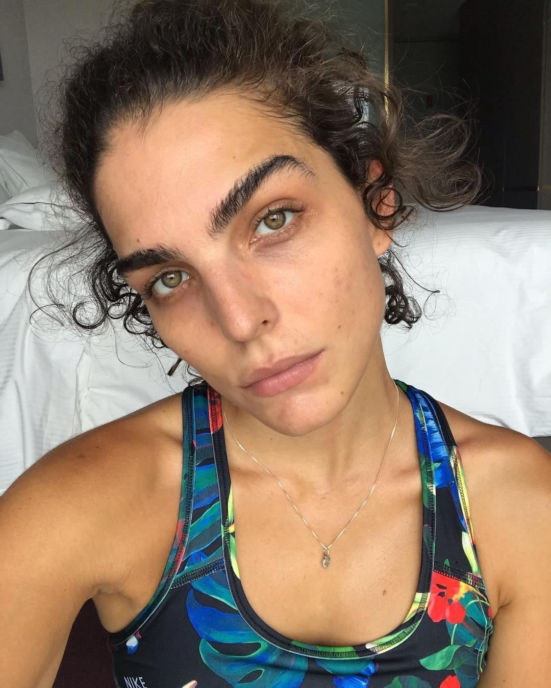 Julia Konrad revela espinhas - Reprodução/Instagram
