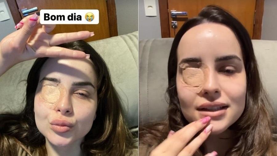 Influencer Jéssica Cardoso machuca córnea com unhas grandes - Reprodução/Instagram/@jessicacardoso
