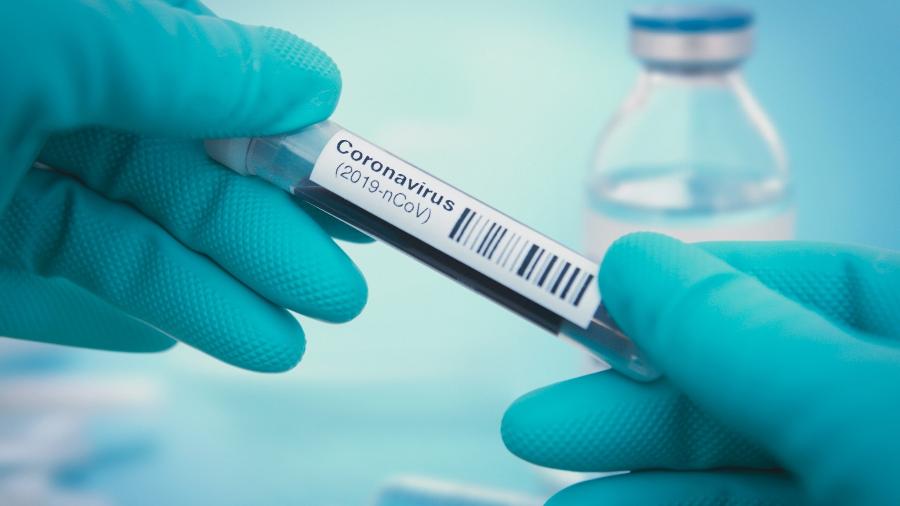 Testes rápidos para o novo coronavírus são feitos utilizando amostras de sangue para procura de anticorpos - iStock