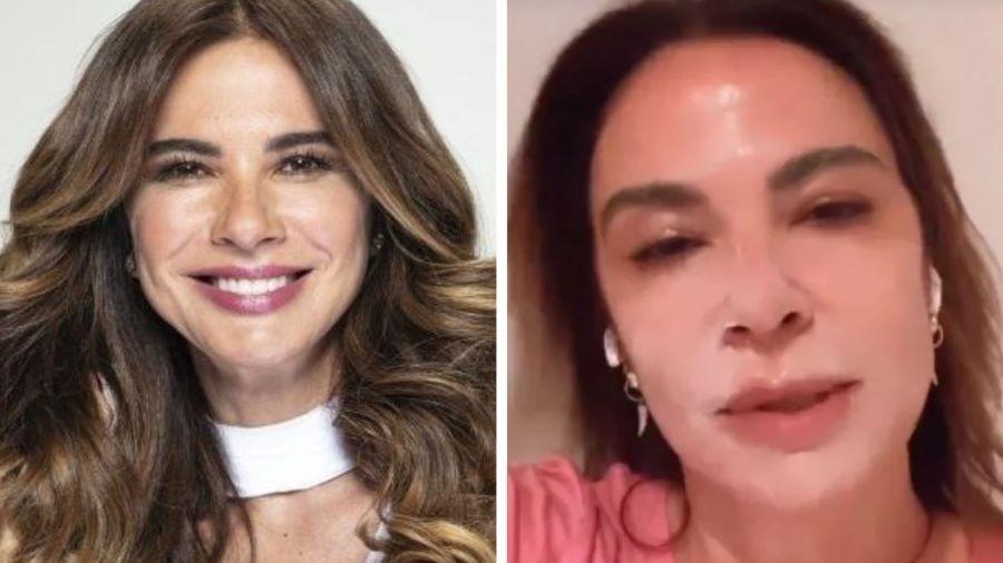 Luciana Gimenez comenta que queimou o rosto - Reprodução/Instagram