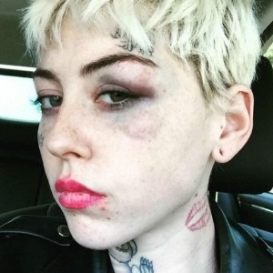 Illma Gore levou um soco no rosto depois de pintar Donald Trump com pênis pequeno - Arquivo Pessoal - Arquivo Pessoal
