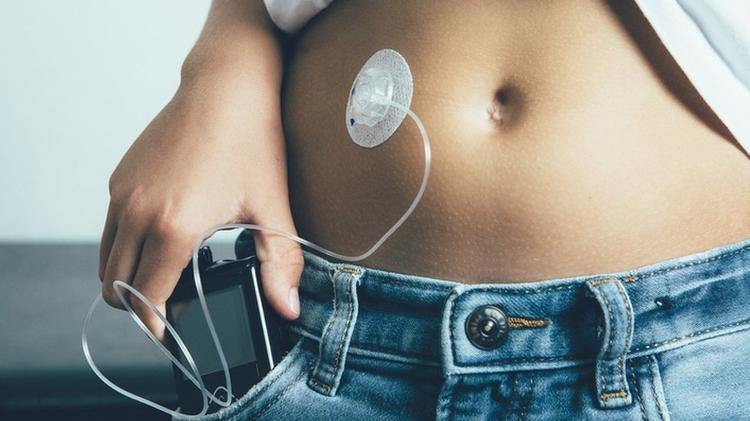 "Nos últimos 10 anos, a prevalência de diabetes tipo 1 aumentou 14 vezes em crianças e adolescentes", aponta especialista - Getty Images