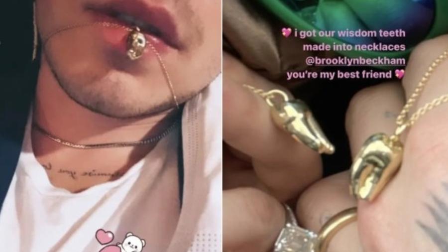 Noiva de Brooklyn Beckham faz pingente de ouro com dentes do casal - Reprodução/Instagram