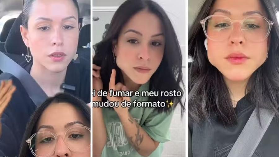 Carol Ribeiro sofreu hipertrofia no masseter por conta do uso contínuo de chicletes - Reprodução/TikTok