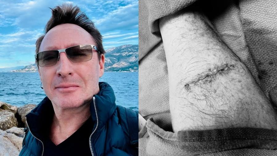 Julian Lennon, filho de John Lennon, fez cirurgia de emergência para retirar câncer - Reprodução/Instagram/X