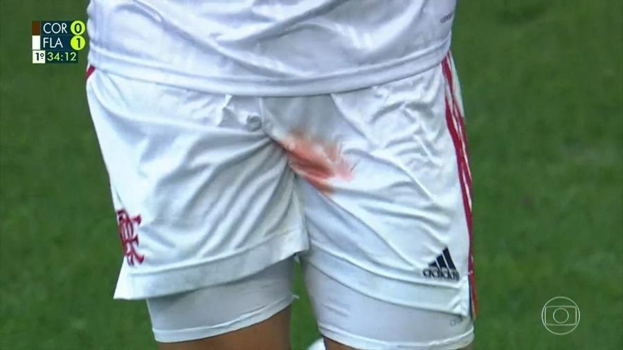 Gustavo Henrique fica com o calção sangrando durante jogo entre Corinthians e Flamengo - Imagem - Reprodução 