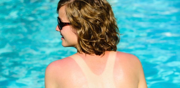 Veja dicas de especialistas para não trocar o bronzeado por marcas feias de sol - Getty Images