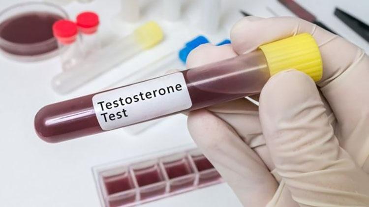 O uso do suplemento de testosterona só é recomendado se houver um diagnóstico médico - Thinkstock - Thinkstock