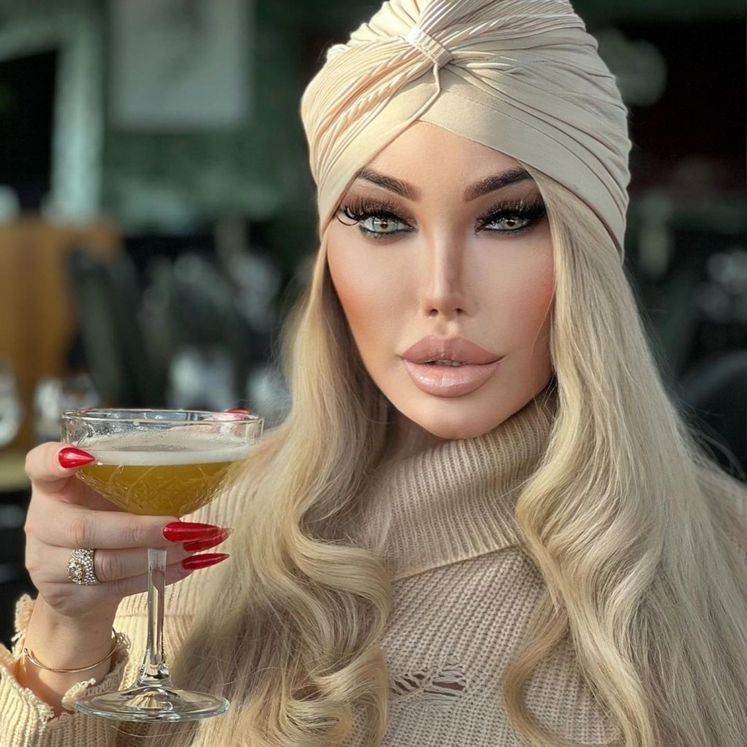 OnlyFans: Jéssica Alves faz nova cirurgia após 13 rinoplastias