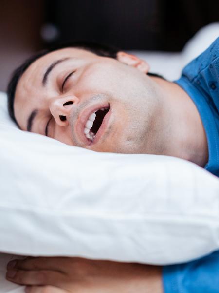 O ronco é um dos sinais de apneia do sono - iStock
