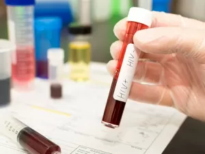 Transplantados infectados: qual o risco de falso negativo em teste de HIV?