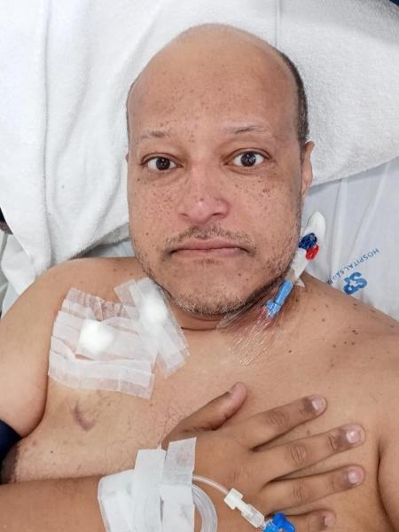 Emerson durante a preparação para o autotransplante de medula, em fevereiro de 2021 - Arquivo pessoal - Arquivo pessoal