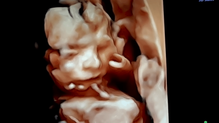 Ultrassom de Lua, filha de Viih Tube e Eliezer - Reprodução/YouTube - Reprodução/YouTube