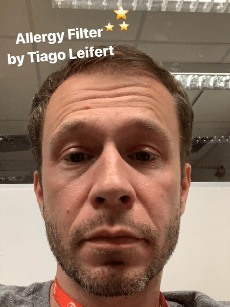 Tiago Leifert explica alergia nos olhos e brinca de tutorial de maquiagem - Reprodução/Instagram