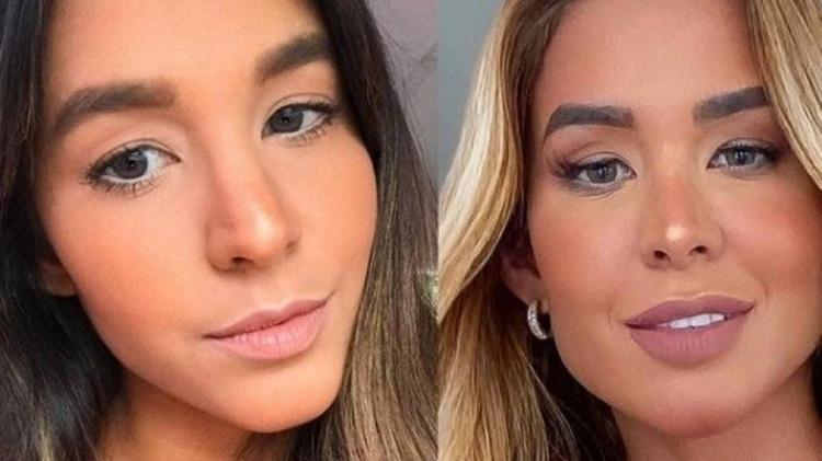 Kerline, antes e depois da harmonização facial - Reprodução - Reprodução